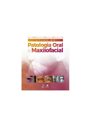 Livro, Atlas de Patologia Oral e Maxilofacial 1/21[LS]