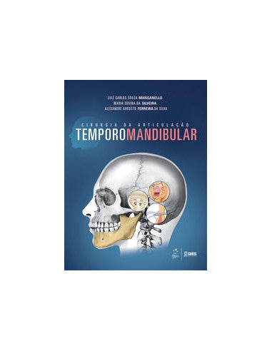 Livro, Cirurgia da Articulação Temporomandibular 1/14[LS]