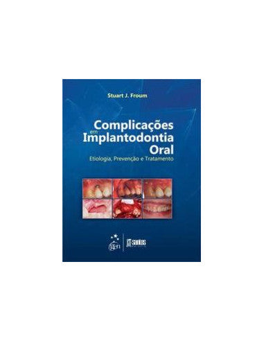 Livro, Complicações em Implantodontia Oral Etiologia Prev Trat 1/13[LS]