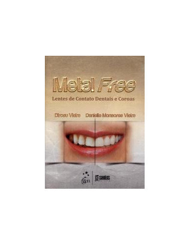 Livro, Metal Free: Lentes de Contato Dentais e Coroas 1/13[LS]