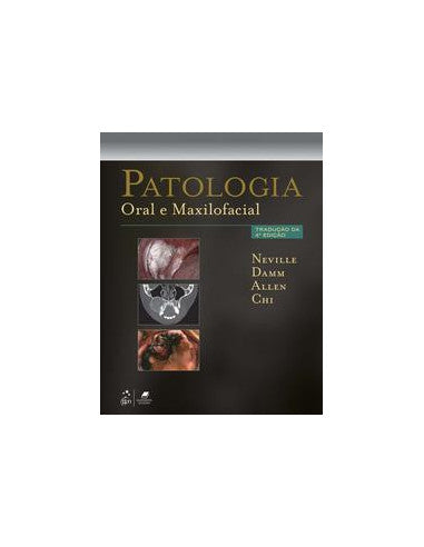 Livro, Patologia Oral e Maxilofacial 4/16[LS]