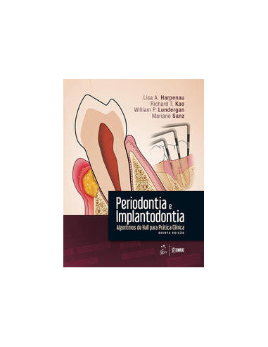 Livro, Periodontia e Implantodontia Algoritmos Hall Prát Clíni 5/16[LS]