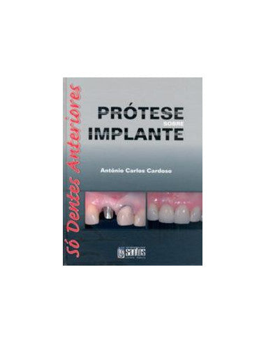 Livro, Prótese Sobre Implante Só Dentes Anteriores 1/08[LS]