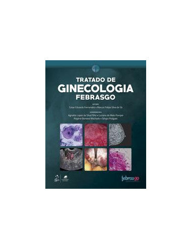 Livro, Tratado de Ginecologia da Febrasgo 1/18[LS]