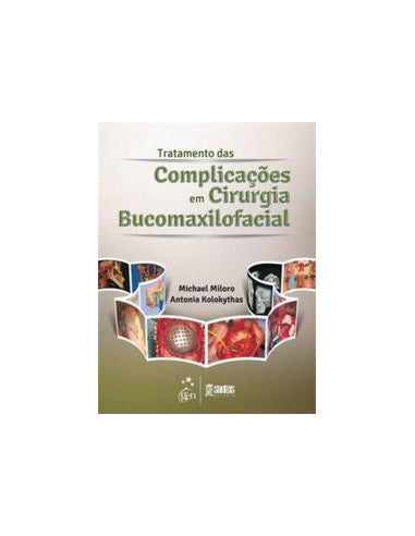 Livro, Tratamento das Complicações em Cirurgia Bucomaxilofacia 1/13[LS]